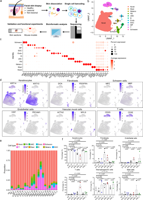Image for Single-cell transcriptomics reveals aberrant skin-resident cell populations and identifies fibroblasts as a determinant in rosacea