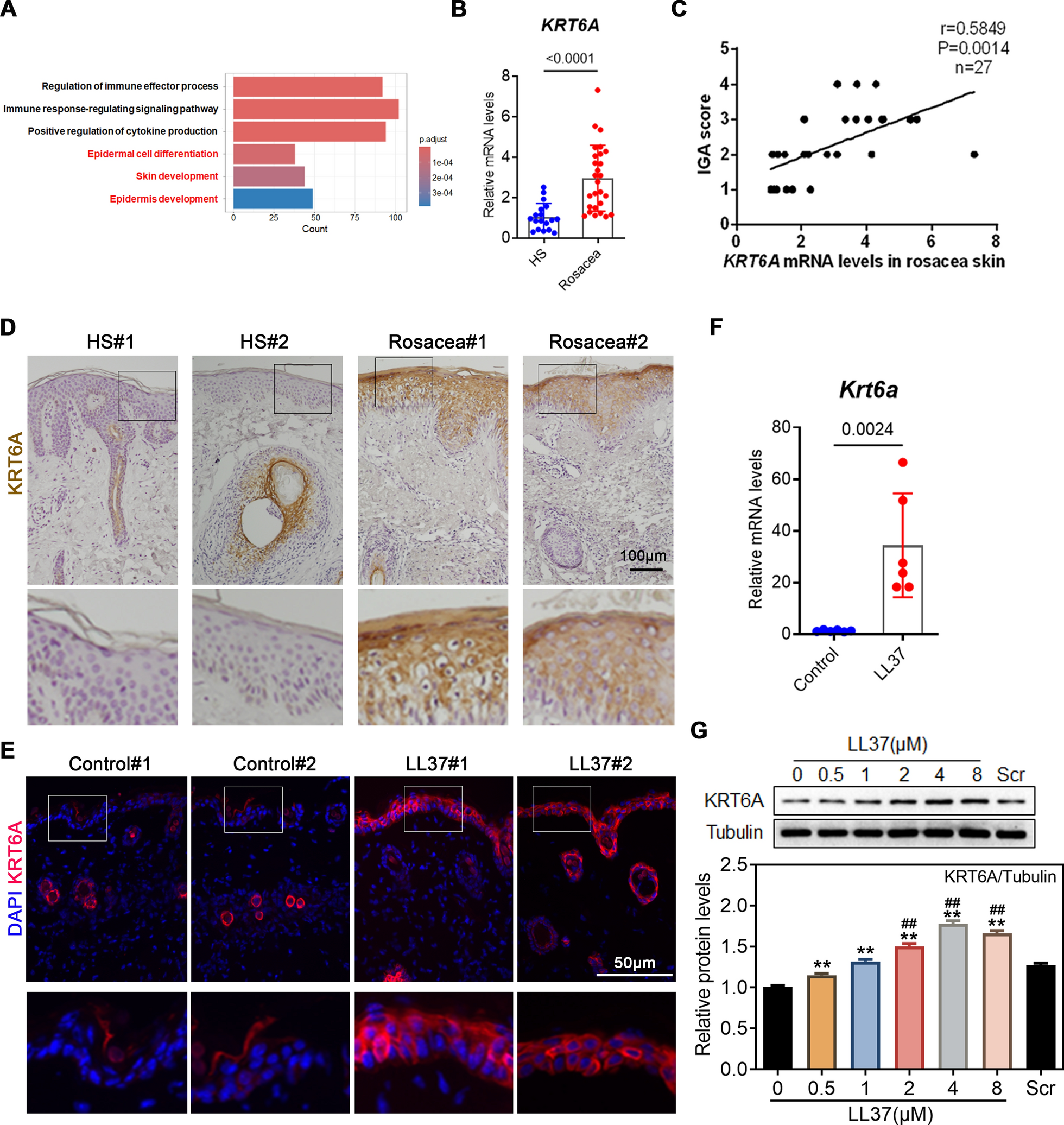 Image for Keratin 6A promotes skin inflammation through JAK1-STAT3 activation in keratinocytes