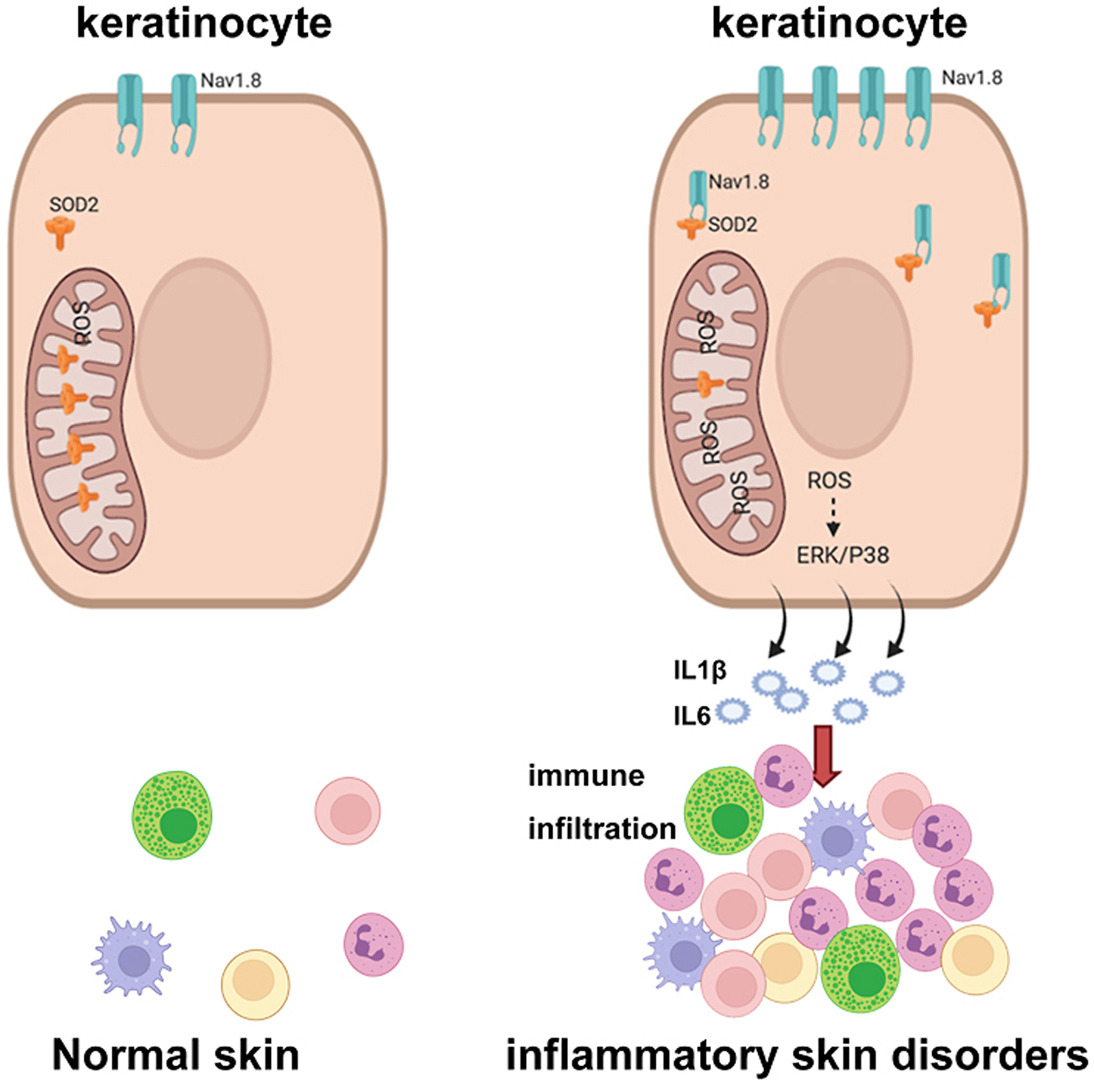 Image for Nav1.8 in keratinocytes contributes to ROS-mediated inflammation in inflammatory skin diseases